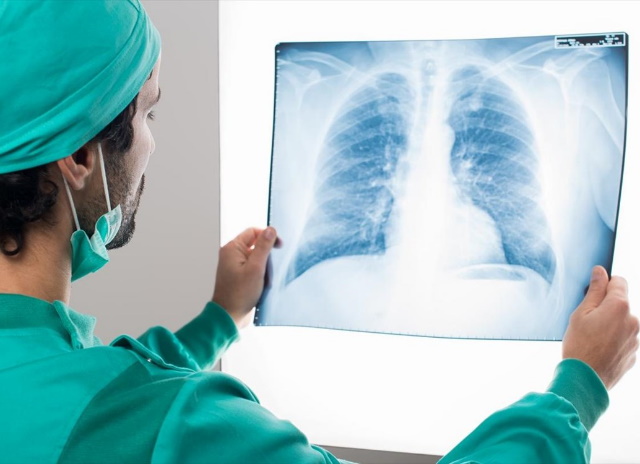 Καρκίνος του πνεύμονα: Τα συμπτώματα σε σημεία του σώματος που τον μαρτυρούν